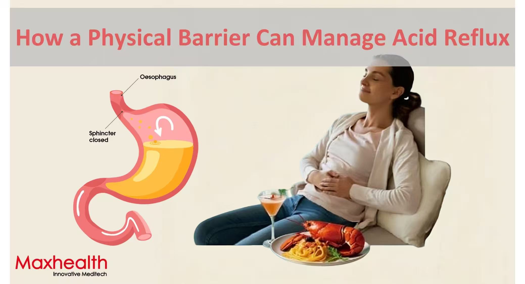 Finding Relief from Heartburn: How a Physical Barrier Can Manage Acid Reflux