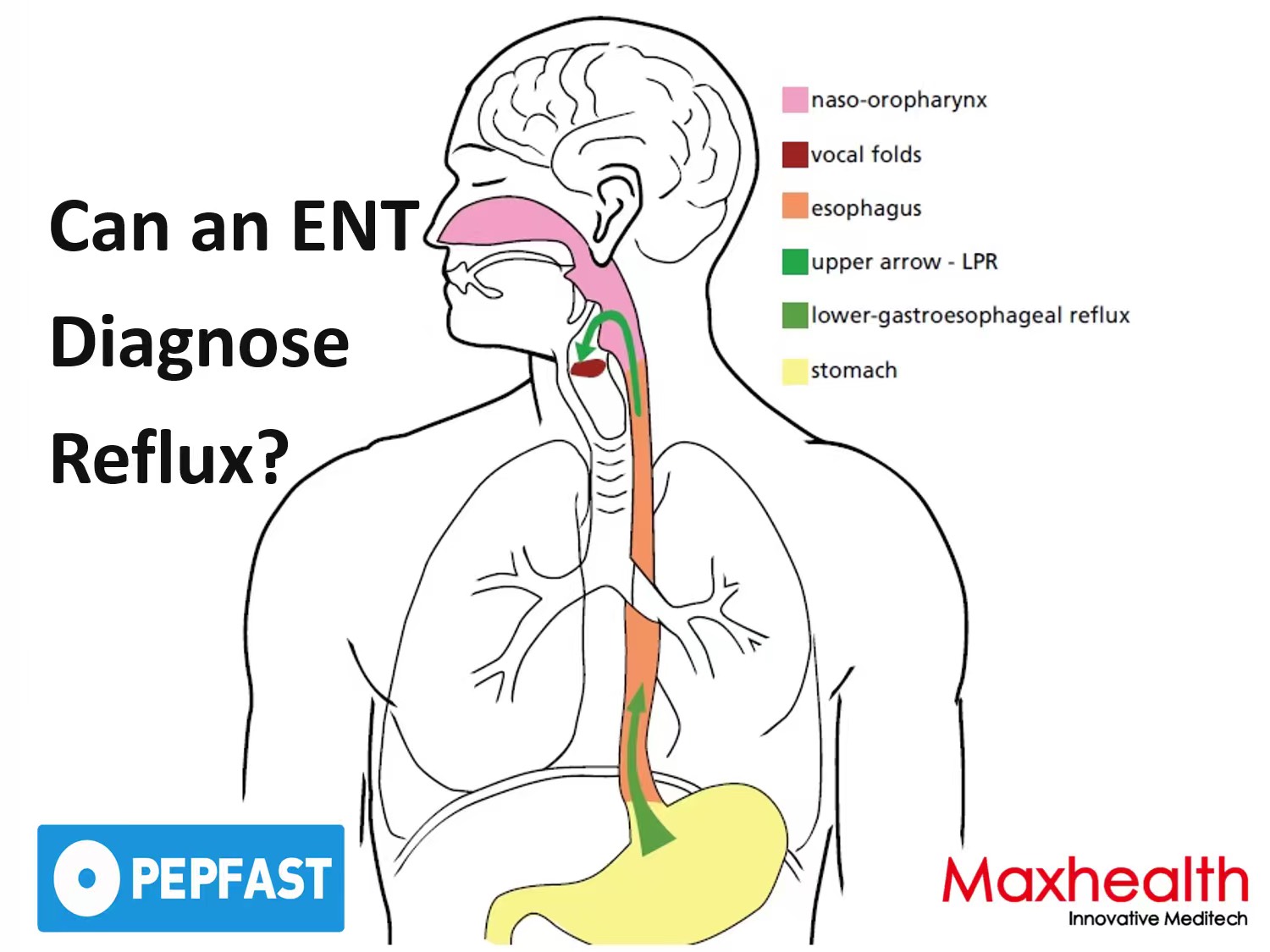 Can an ENT Diagnose Reflux? The Role of ENT Specialists in Silent Reflux