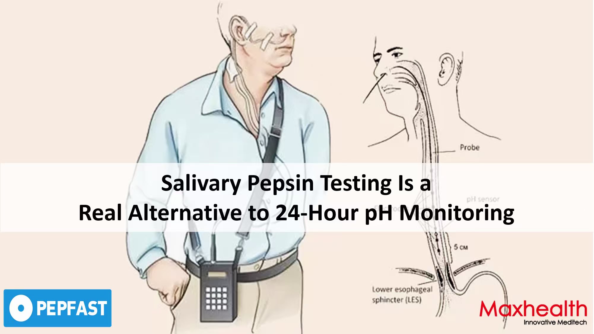 Why Salivary Pepsin Testing Is a Real Alternative to 24-Hour pH Monitoring