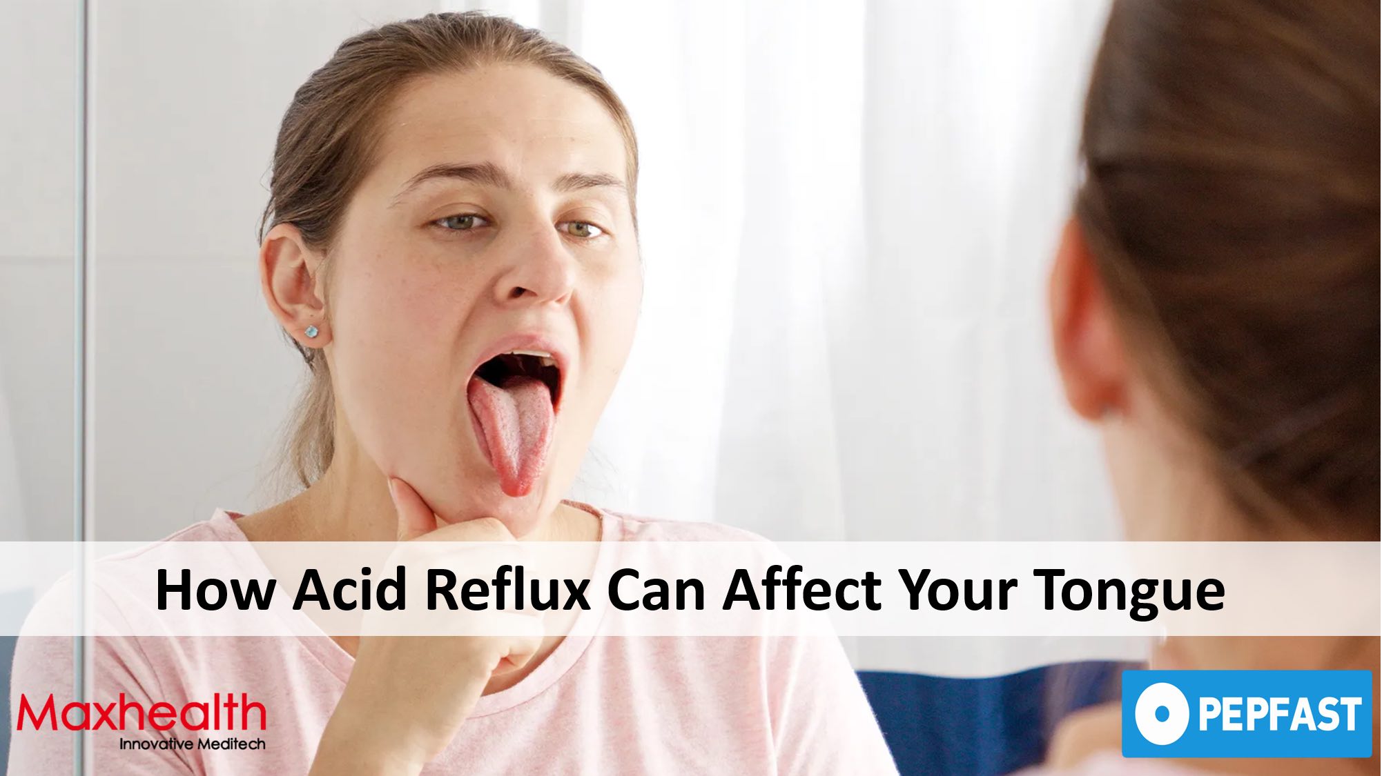 The Oral Clue: How Acid Reflux Can Affect Your Tongue